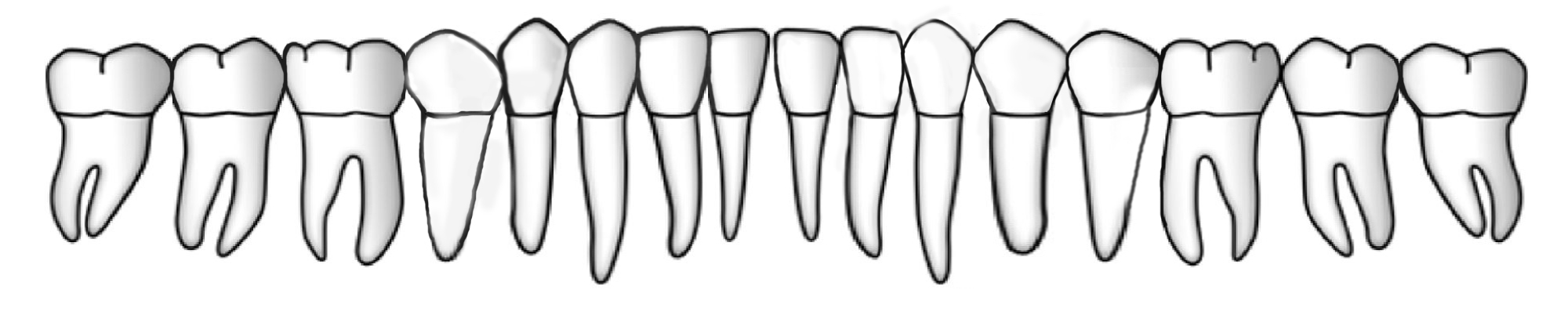Arcada inferior, cara vestibular