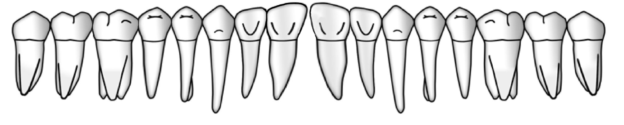 Arcada superior, cara palatina